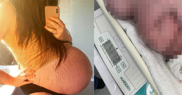 Mladá maminka šokovala lékaře, miminko se stalo v nemocnici celebritou. Kolik vážilo a jak moc byl porod náročný? Náhledový obrázek