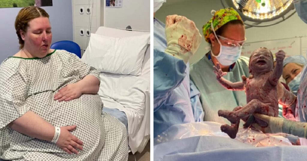 Obézní žena odmítla potrat i přes naléhání lékaře. Když jí otevřeli břicho, všechny to ohromilo Náhledový obrázek