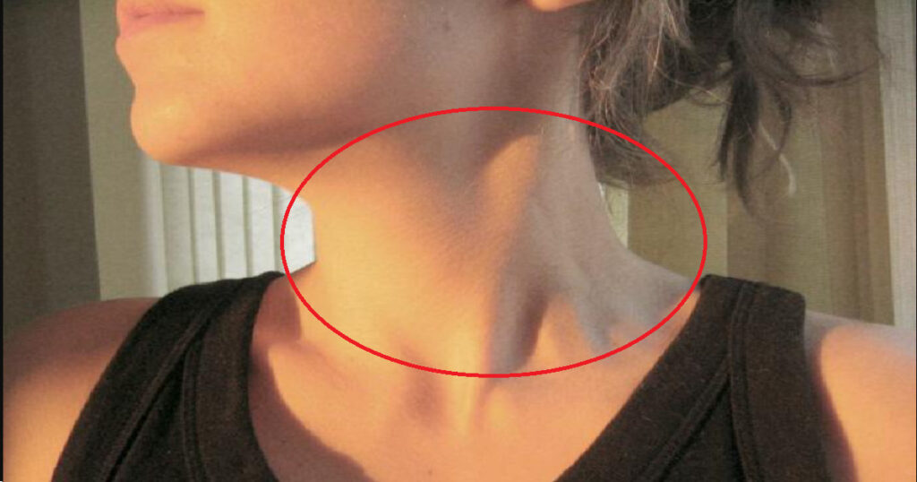 Když budete jíst těchto 8 potravin, vaše štítná žláza vám zaručeně poděkuje. Tohle je důvod Náhledový obrázek