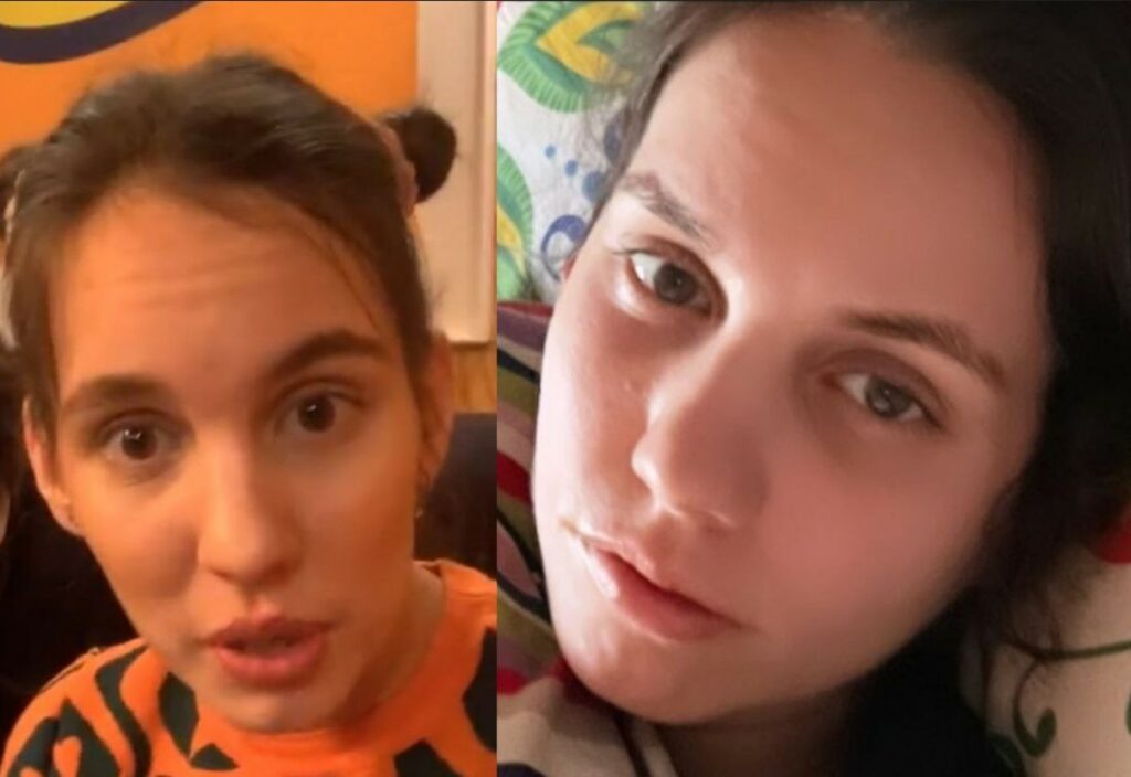 Obavy o syna ji dostaly na kolena: Michaele Tomešové vypadlo 66 % vlasů Náhledový obrázek