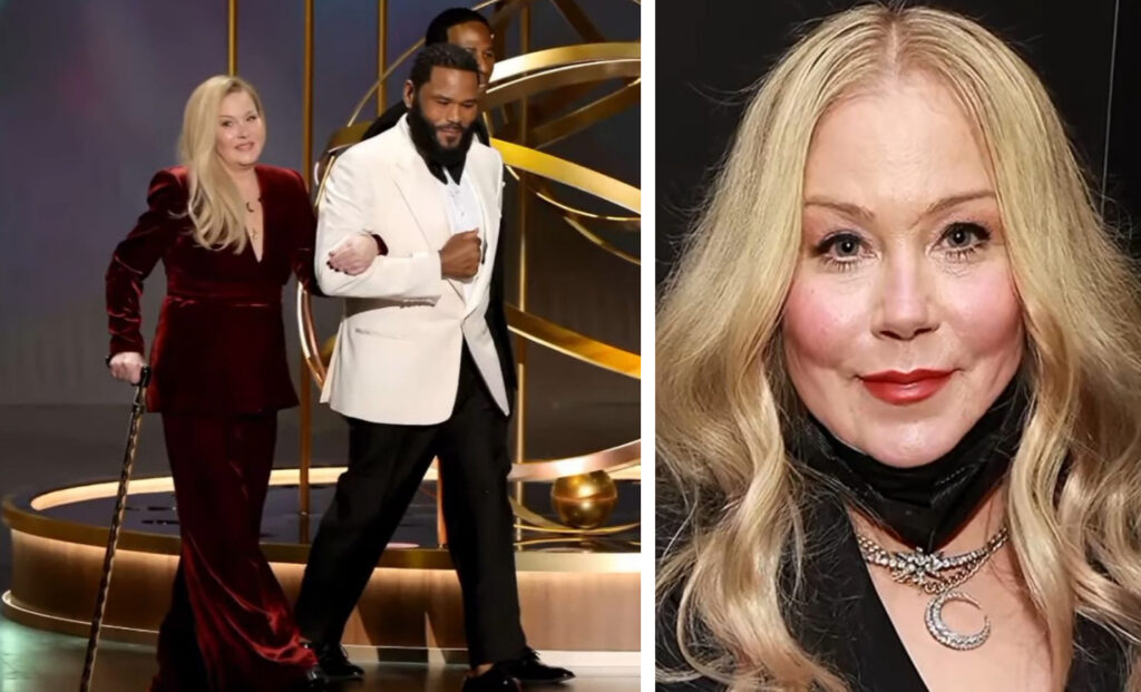 Christina Applegateová trpí každý den. Tato nemoc ji dohání k šílenství Náhledový obrázek