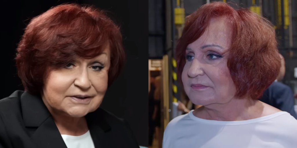 Petra Janů dlouho řešila následky plastiky obličeje. Nyní ji trápí další problém. Tohle musí udělat Náhledový obrázek